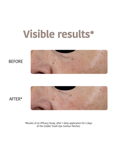 IROHA NATURE Patches - maske med 24...