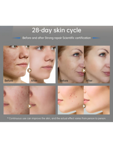 Dr. Pen M9 microneedling-pen 2.0 –...