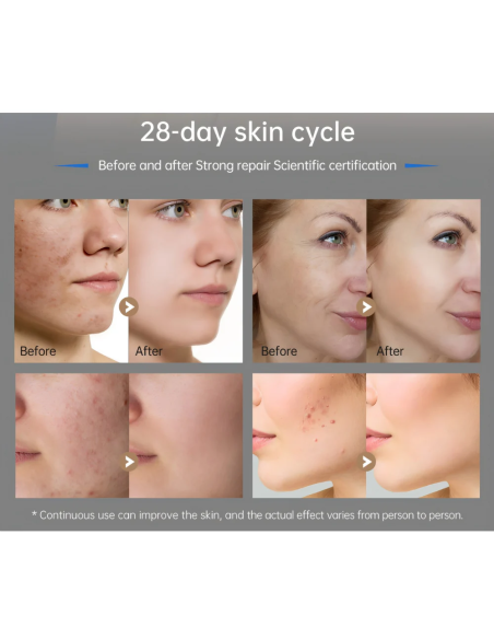 Dr. Pen M9 microneedling-pen 2.0 – intelligent microneedling i ny generation