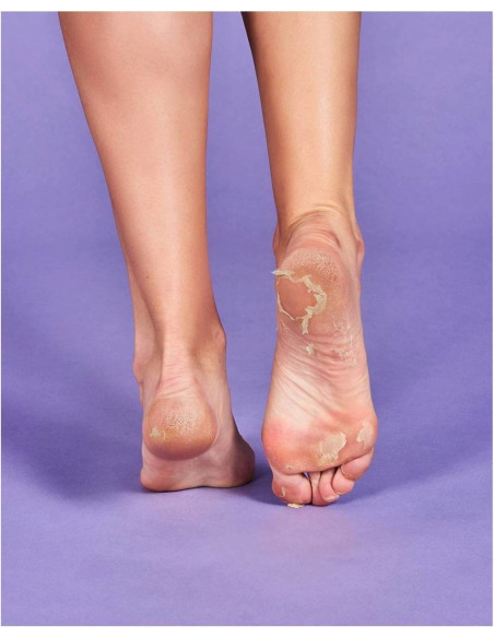 IROHA NATURE Peeling- og eksfolieringssokker Lavendel