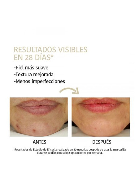 IROHA NATURE Peeling ansigtsmaske med glykolsyre 23 ml
