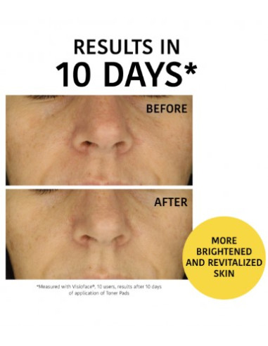 IROHA NATURE Peeling og Brightening...