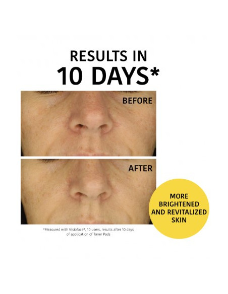 IROHA NATURE Peeling og Brightening Toner Pads med glykolsyre og ananasenzymer 10 stk.